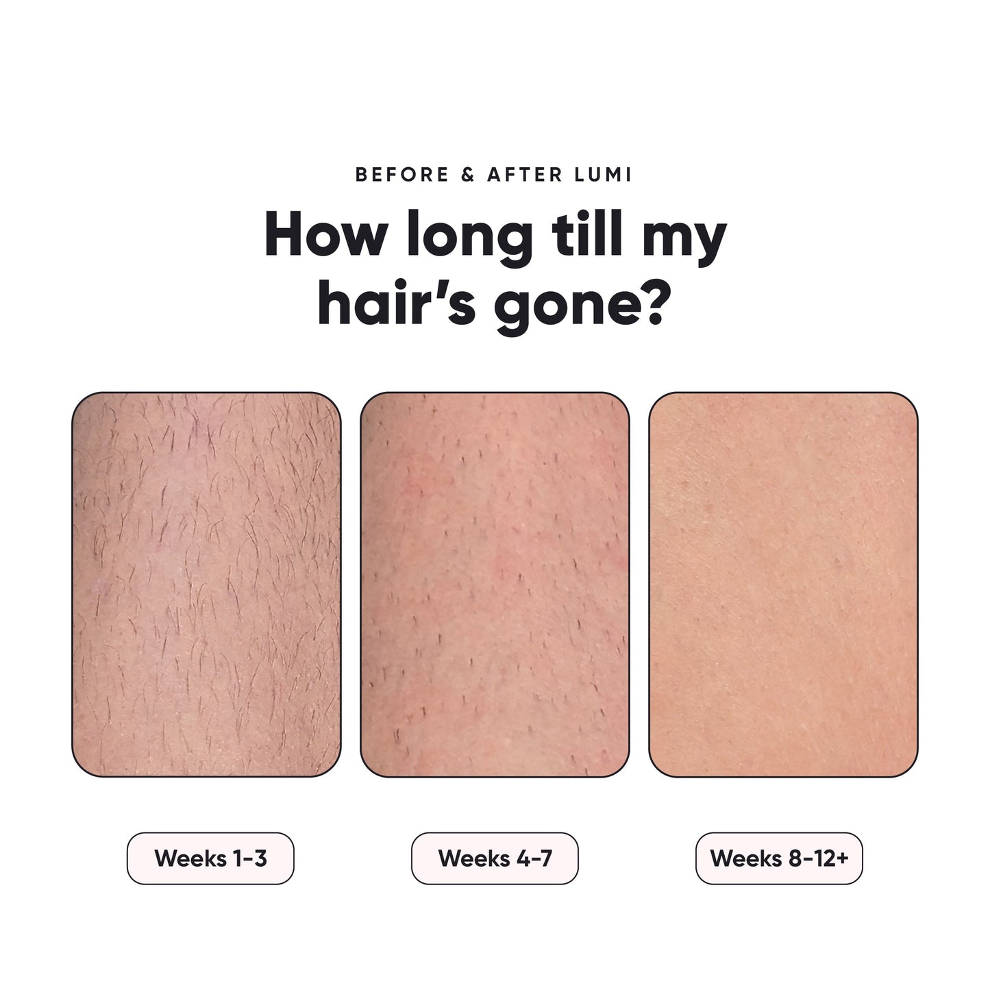 Silky Smooth Hair Remover