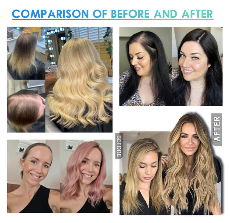 Youthful Volume Hair Topper