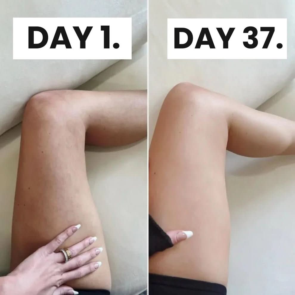 Smooth Skin Cellulite Kit