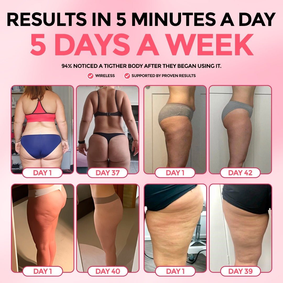 Smooth Skin Cellulite Kit