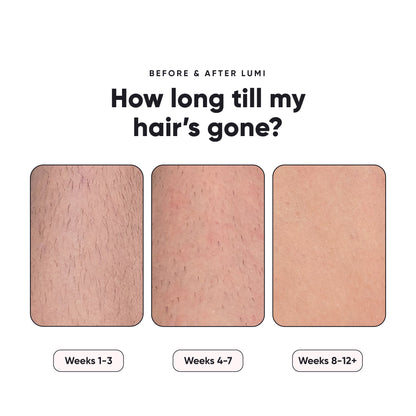 Silky Smooth Hair Remover